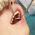 Cirugía Dental