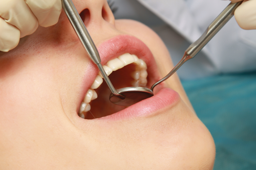 Qué hacer después de una cirugía oral