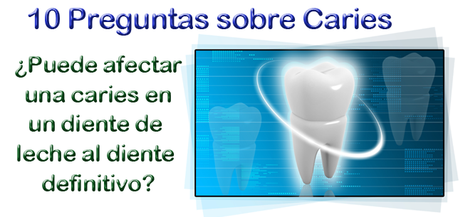 ¿Puede afectar una caries en un diente de leche al diente definitivo?